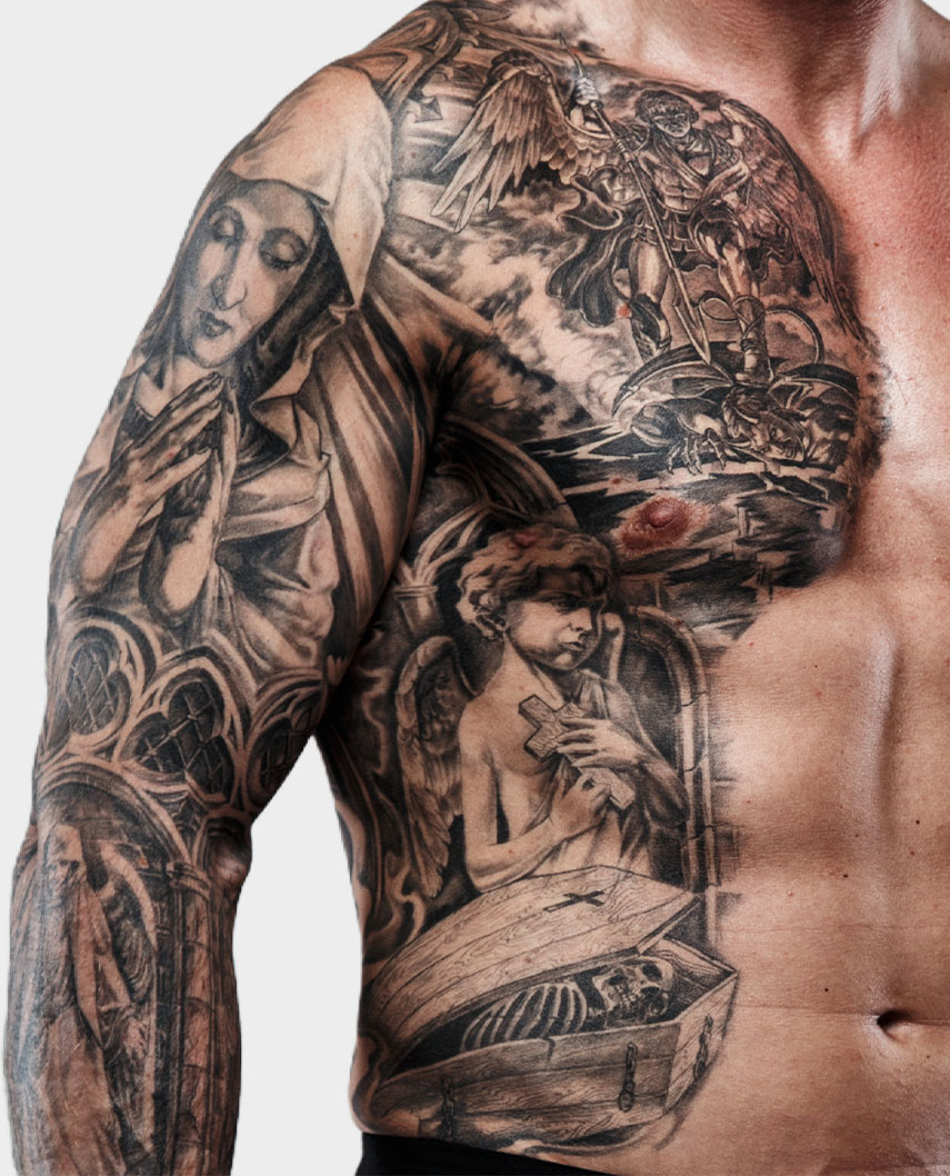 remoción de tatuajes